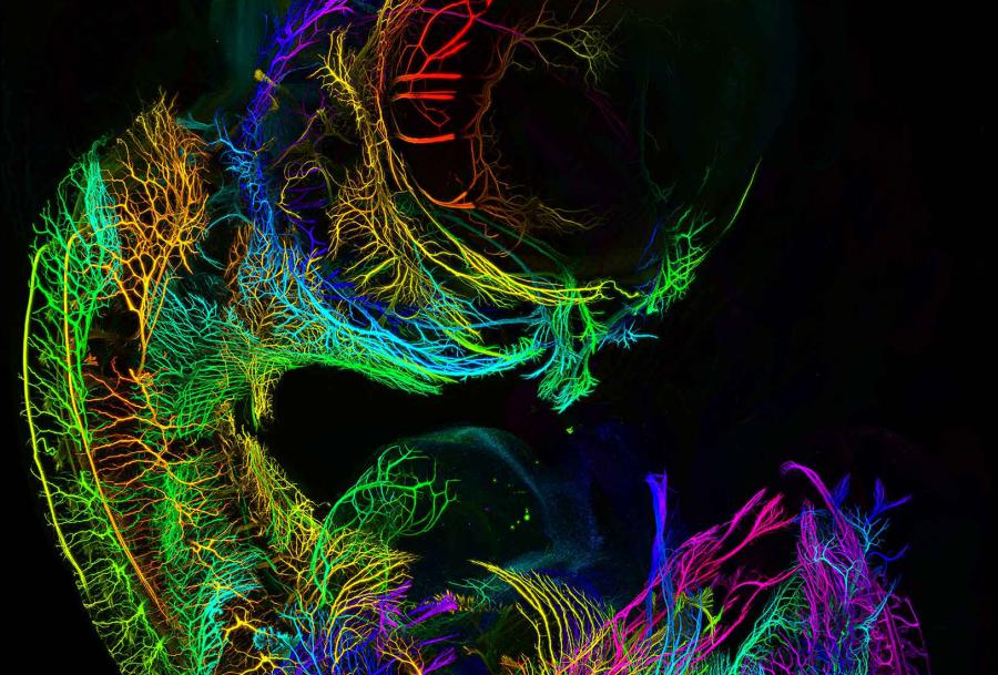 Researchers around the world share their stunning images and insights: The open source mesoSPIM Initiative